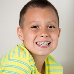 young boy with braces