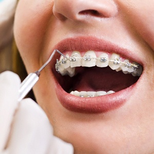 orthodontic checkup