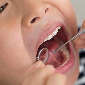 Closeup of child receiving dental exam