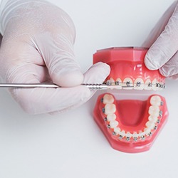 a dentist working on a model of traditional braces