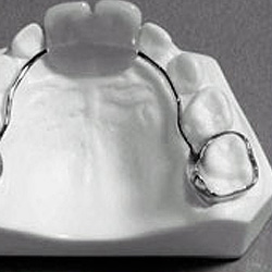 Model smile with pedo-partial denture