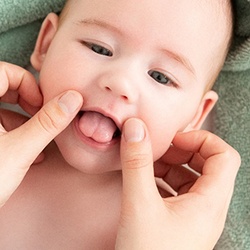 Baby receiving fluoride treatment in Casper