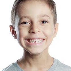 Boy with missing tooth in Casper