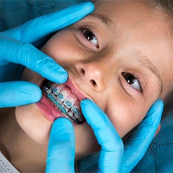 Orthodontist with blue gloves examining child's braces