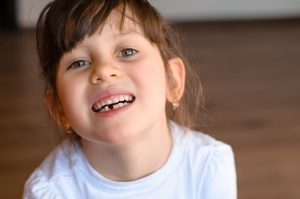 a child who recently lost a tooth smiling